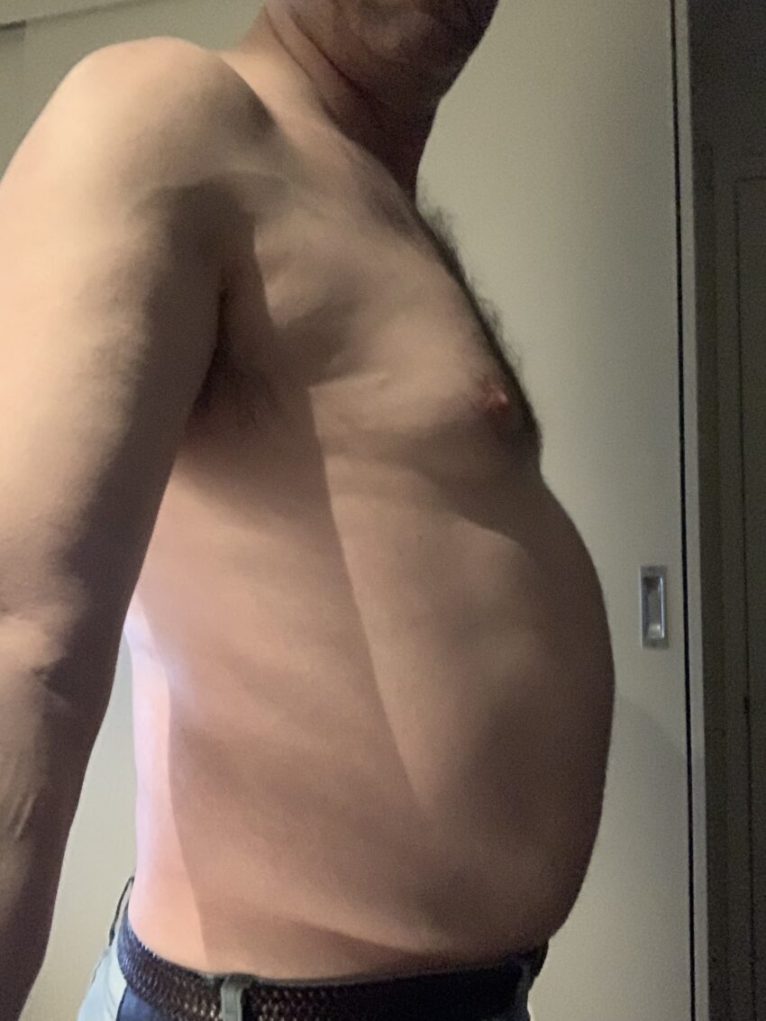 skinny fat